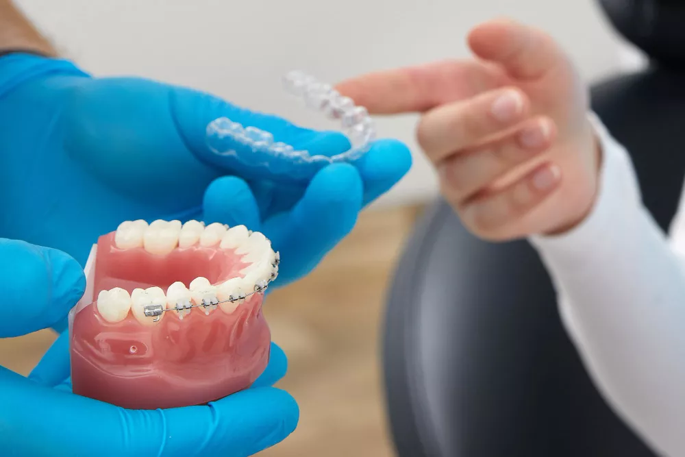 Aligners & Braces